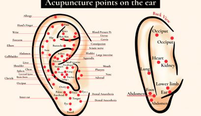 acupuncture, ear, anaesthesia, stress, anxiety