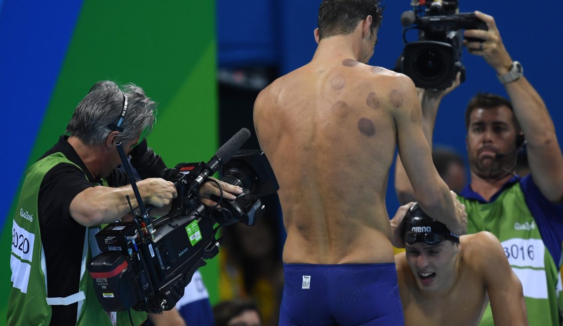 The Greatest Olympian Of All Time Michael Phelps Loves Cupping!